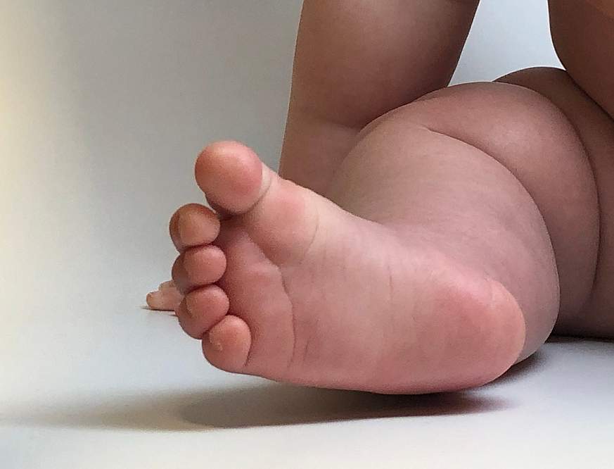 A baby’s foot and leg