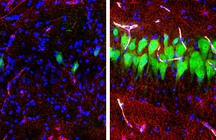 Images of pig brain scans