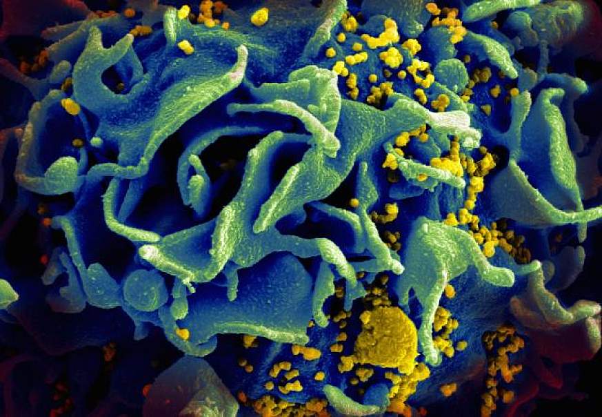 HIV-infected T cell