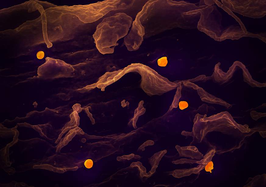 Microscopic image of Nipah virus