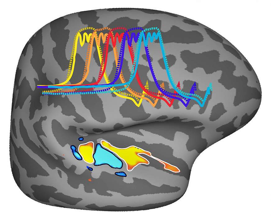Tuned for Musical Pitch: NIH-funded scientists found that our brains may be uniquely sensitive to pitch, the harmonic sounds we hear when listening to speech or music. 