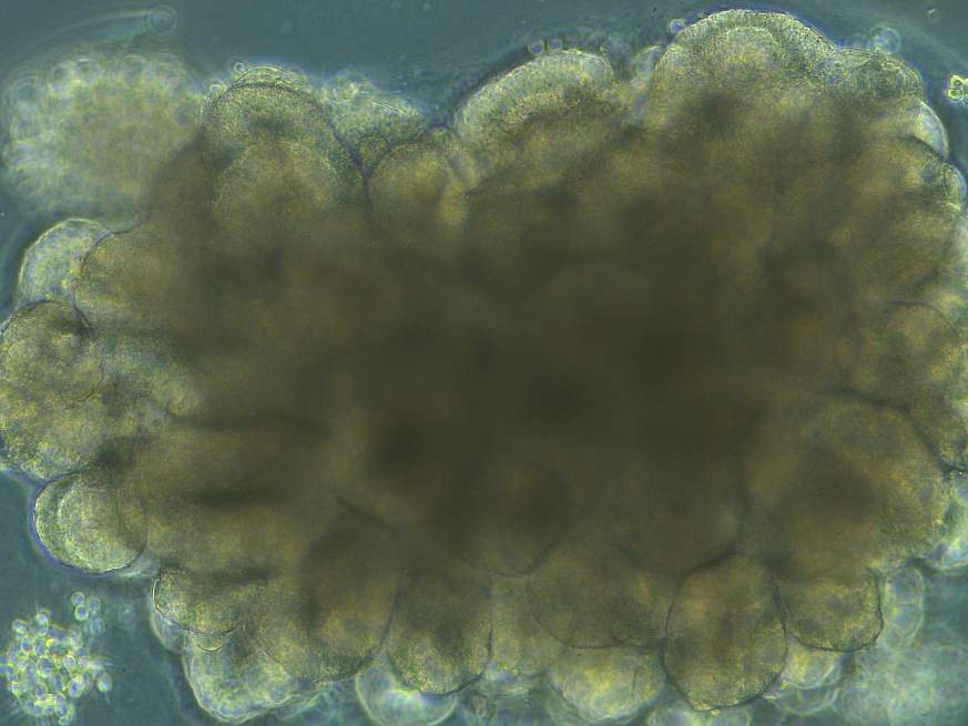 Microscopic image of an organoid during development