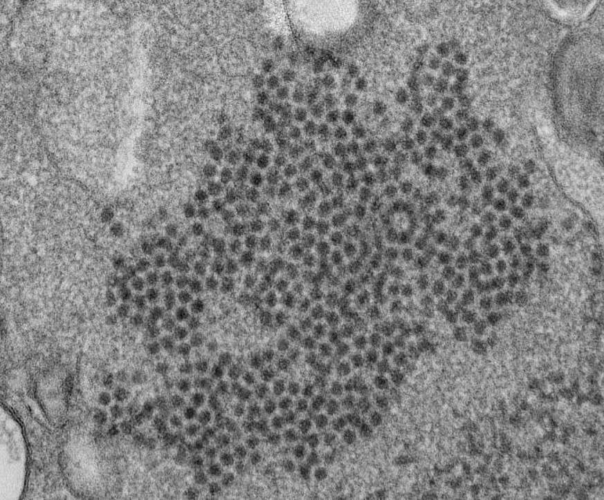 This photo shows an electron micrograph of a thin section of EV-D68, showing the numerous, spherical viral particles.