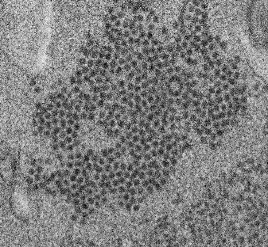 micrograph of EV-D68 particles