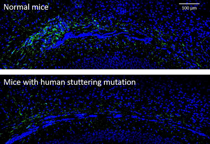 Images of astrocyte activity in mice