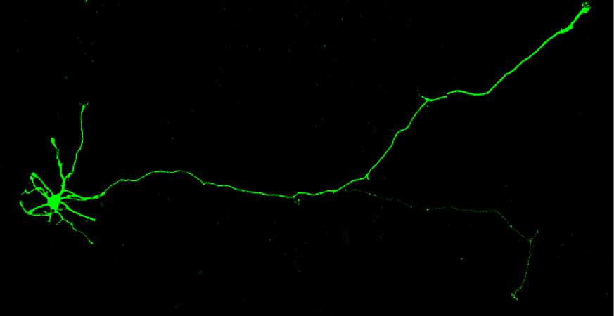 Image of a neuron