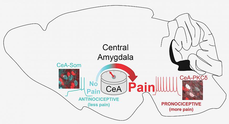 The central amygdala (CeA) functions as a pain rheostat in the forebrain, enhancing or attenuating pain. Modulation of pain is accomplished by cell-type-specific changes in activity after injury. Activity in CeA-PKCδ neurons drives increases in pain-relat