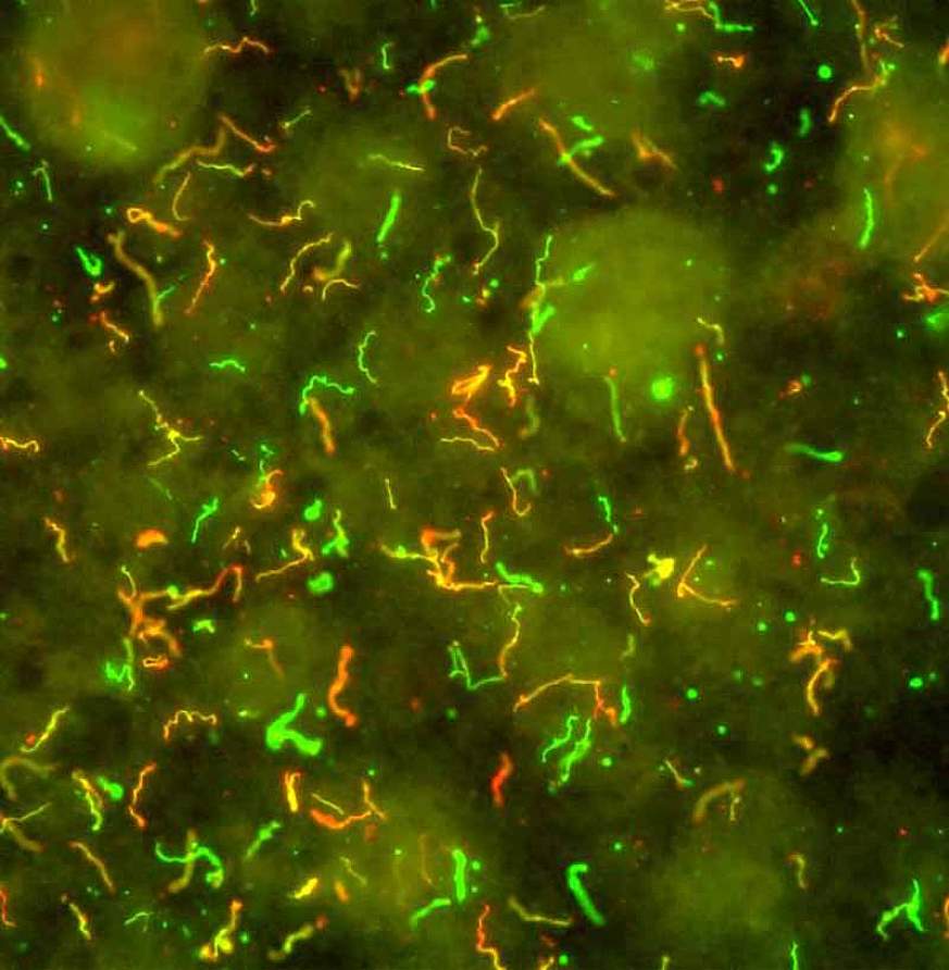 Image of spiral-shaped bacteria 