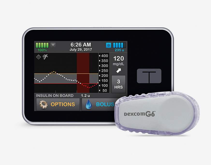 Image of continuous glucose monitor and insuline pump