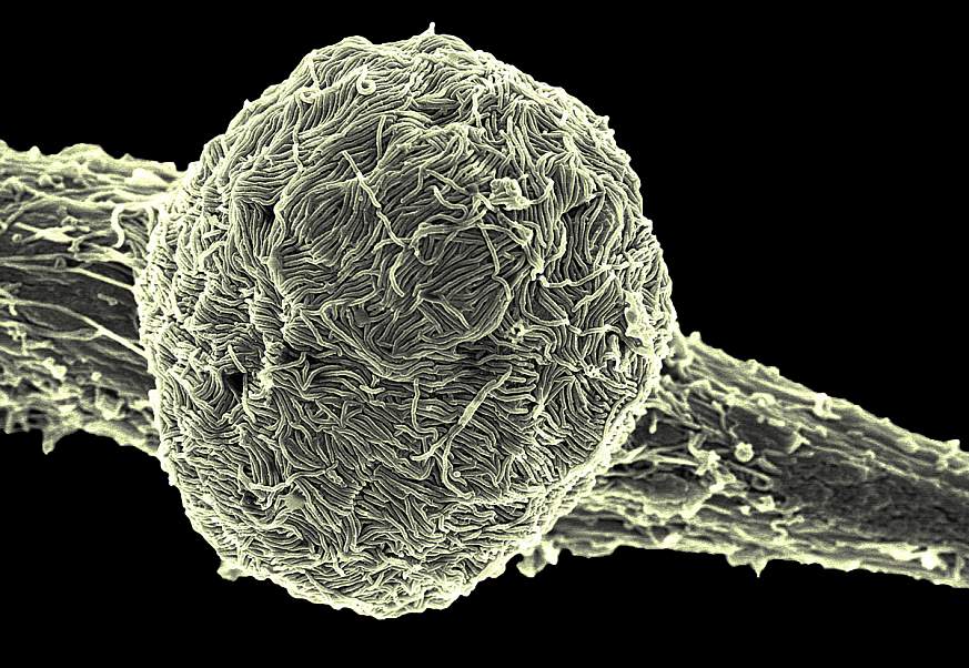 Ebola virus Makona covering the surface of an infected cell. 