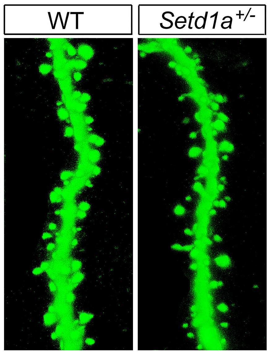 Image of neuronal spines