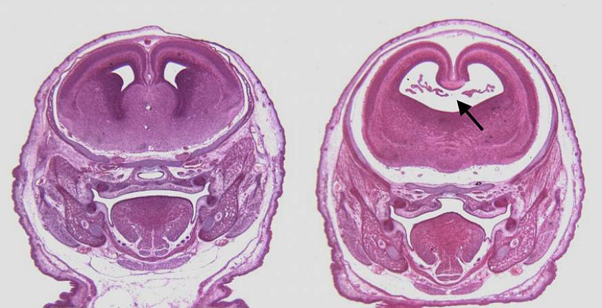 Stained sections of fetal mouse brains.  
