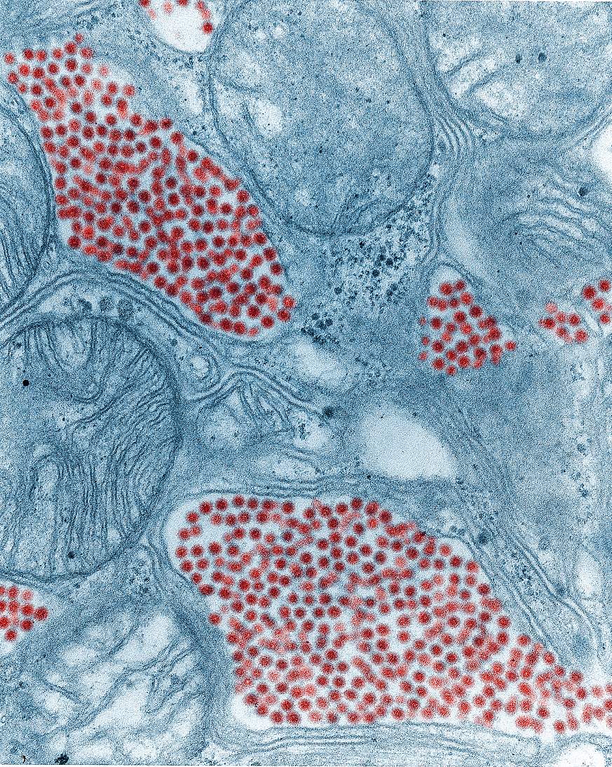 eastern equine encephalitis (EEE) virus