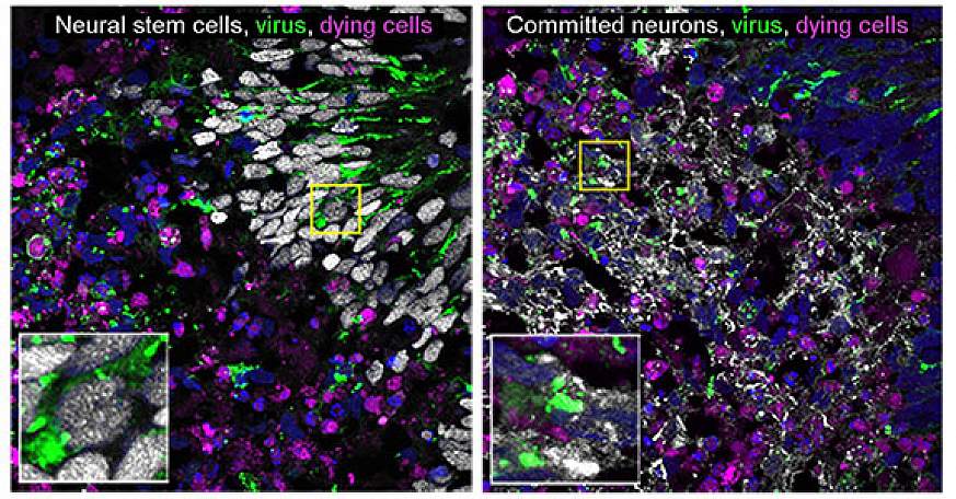 Cells infected with La Crosse virus.