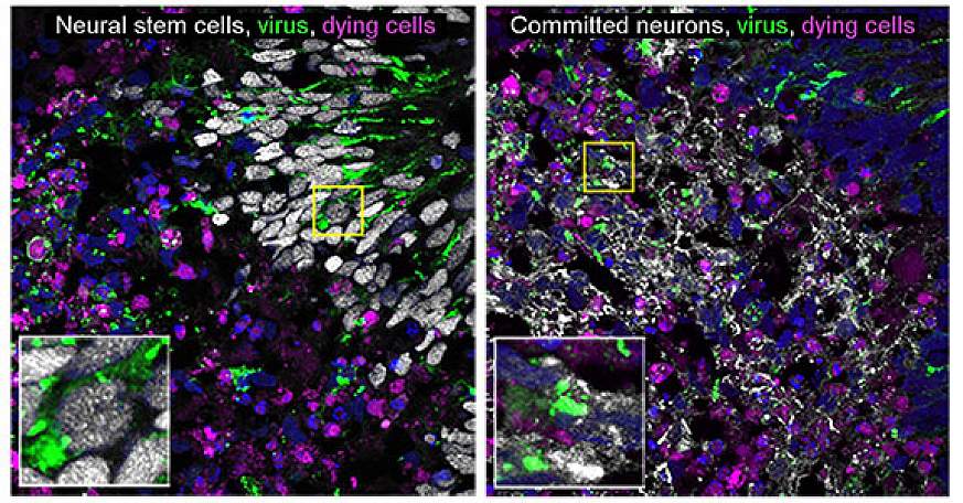 Cells infected with La Crosse virus.