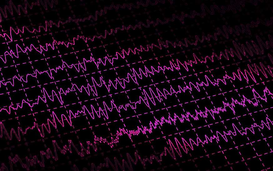 Image showing brain electrical activity