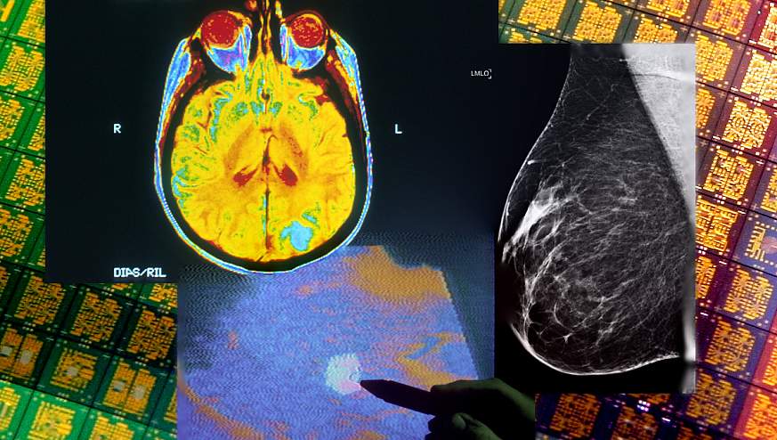 Brain CT, ultrasound, and mammogram overlaid on background image of silicon chips.