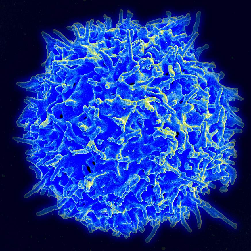 Micrograph of a human T cell