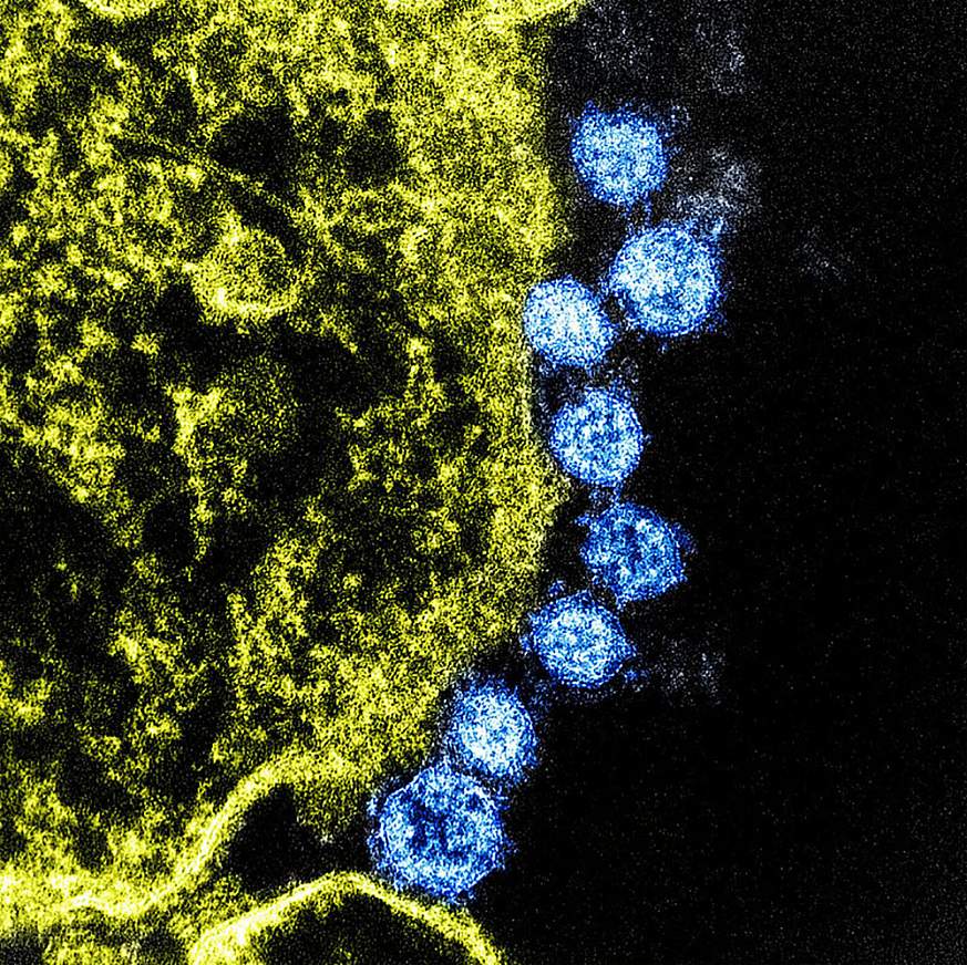 MERS coronavirus and cell