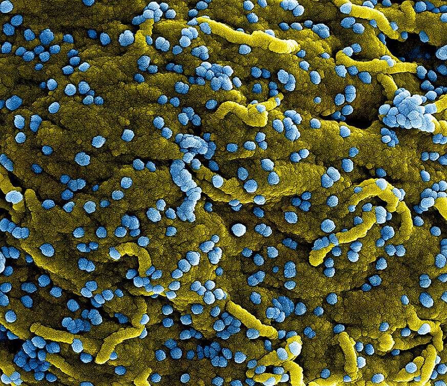 MERS Coronavirus Particles