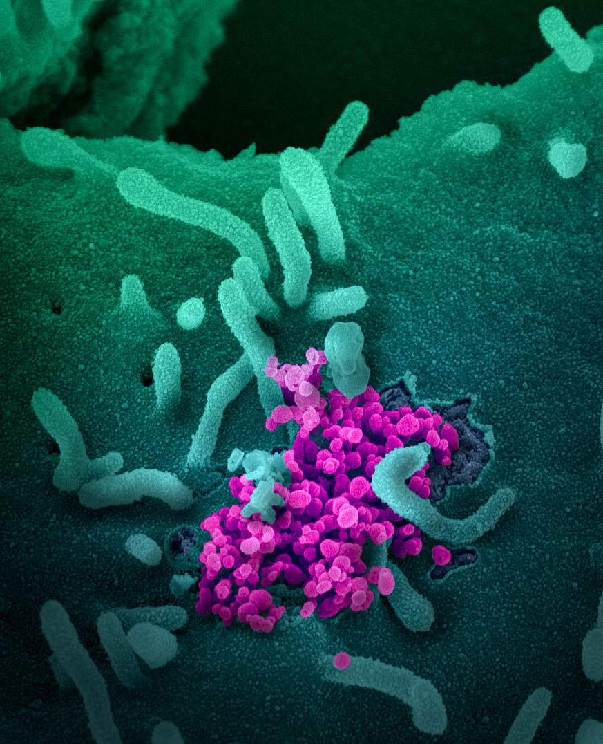 Novel Coronavirus SARS-CoV-2