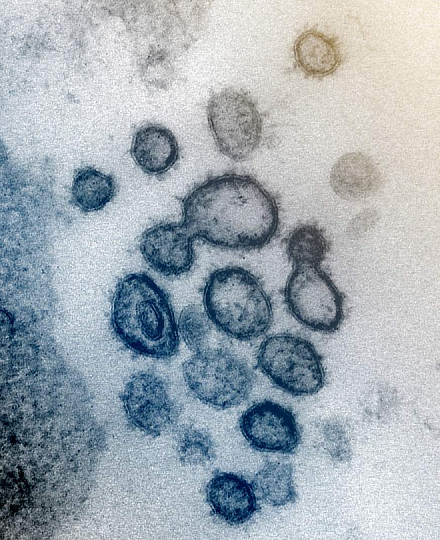 Coronavirus particles