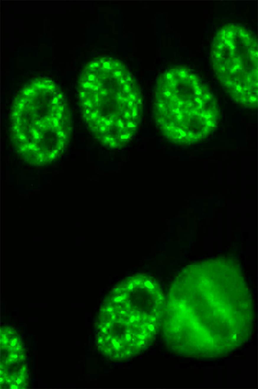 Photo of human cells showing ANA