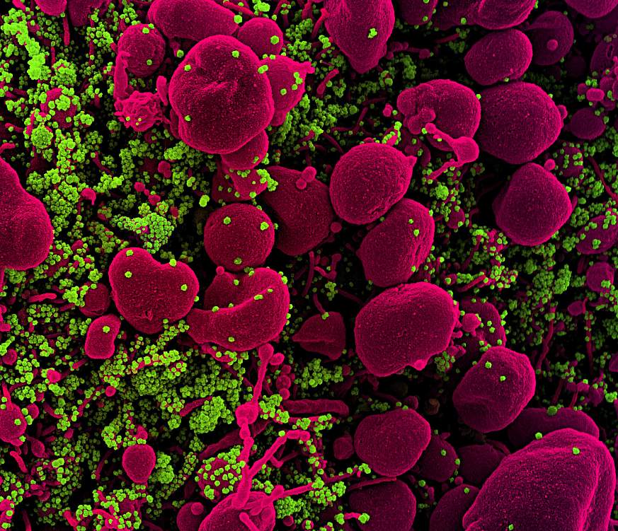 Novel Coronavirus SARS-CoV-2