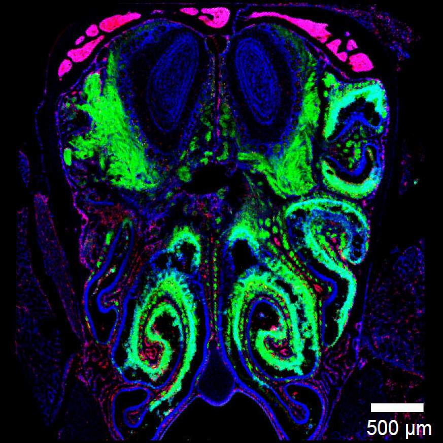 Image of a brain scan