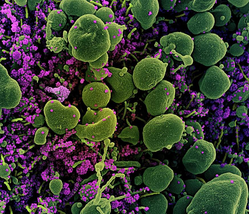 Novel Coronavirus SARS-CoV-2