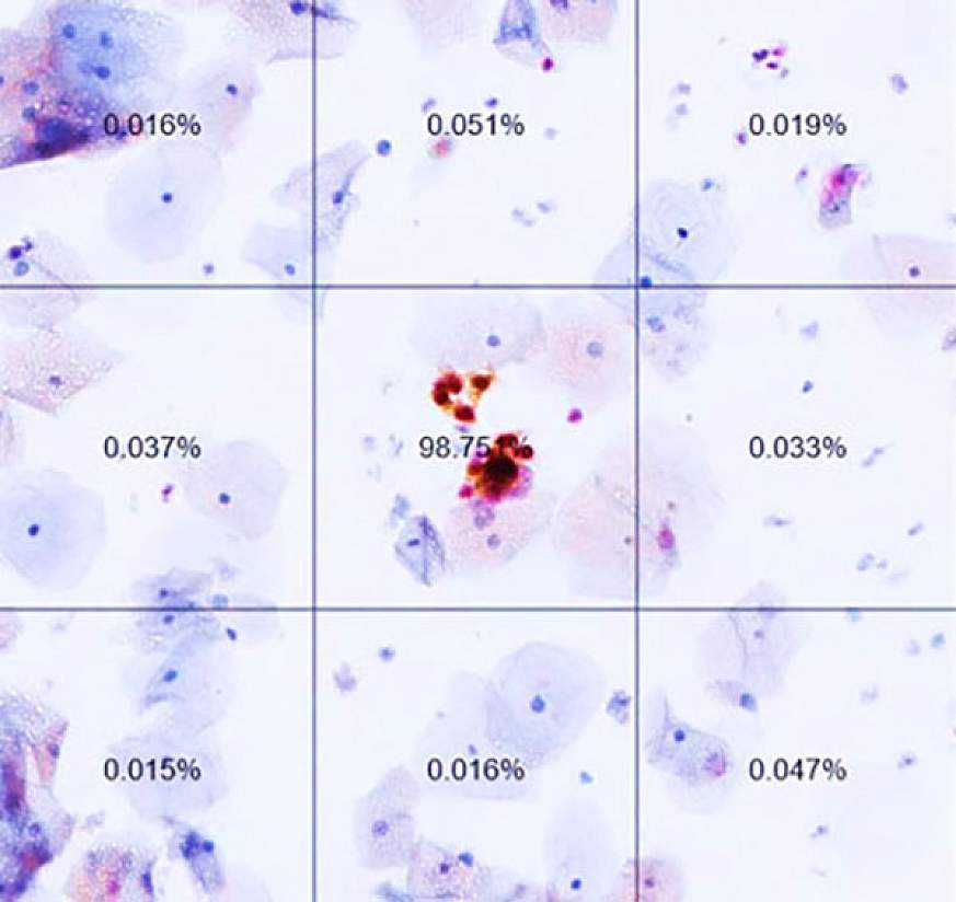 Image of a slide from an automated dual-stain cytology test. 