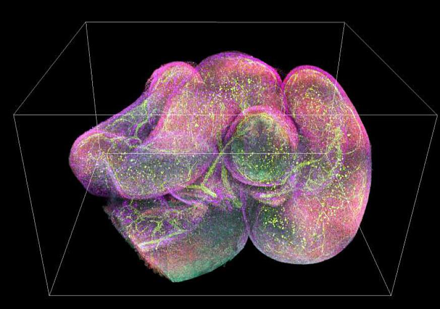 A 3D image of intestines 