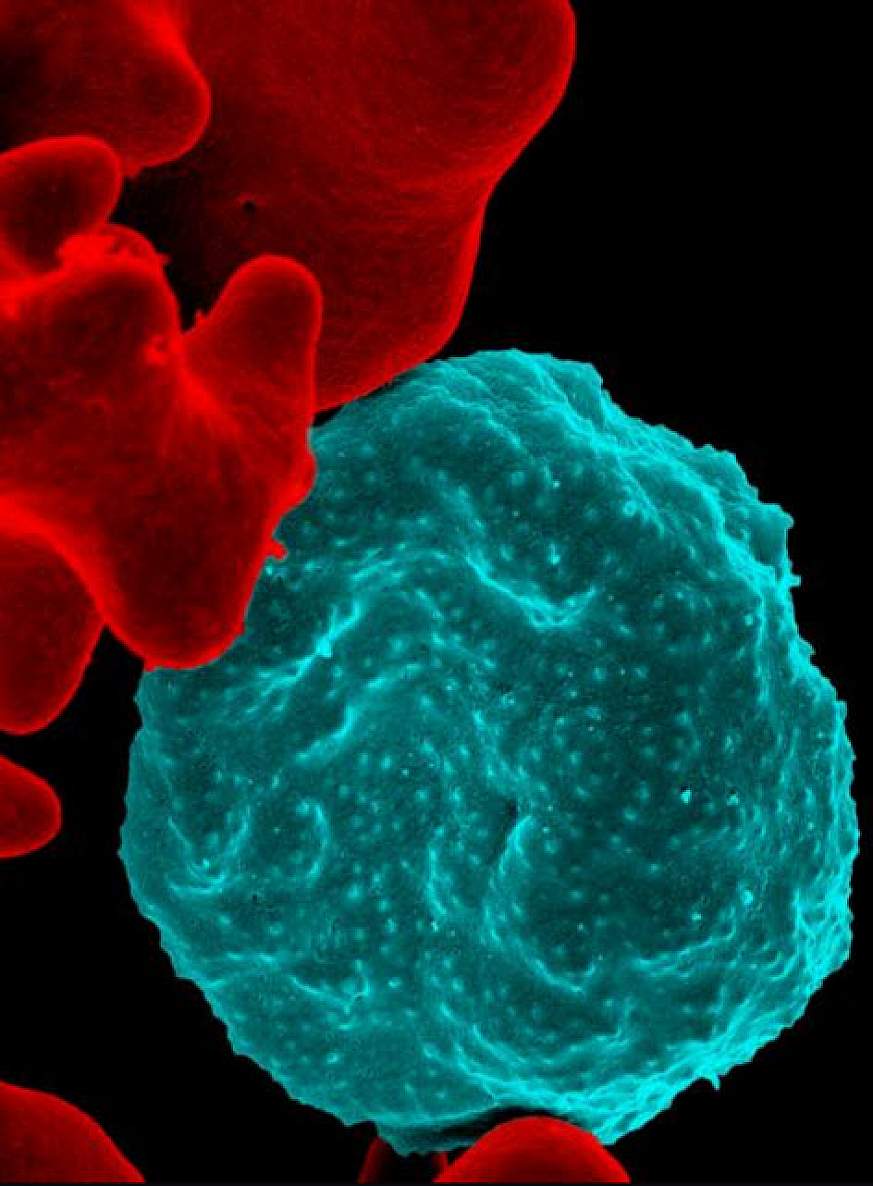 NIAIDFollow Malaria-infected Red Blood Cell