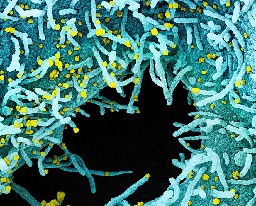 Novel Coronavirus SARS-CoV-2