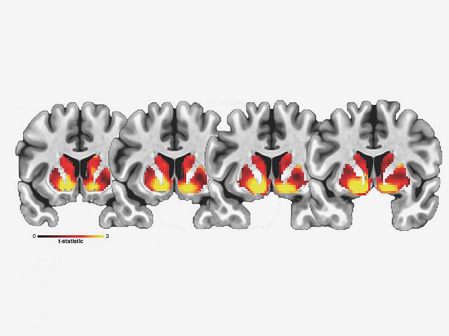 Images of brain scans used in the study