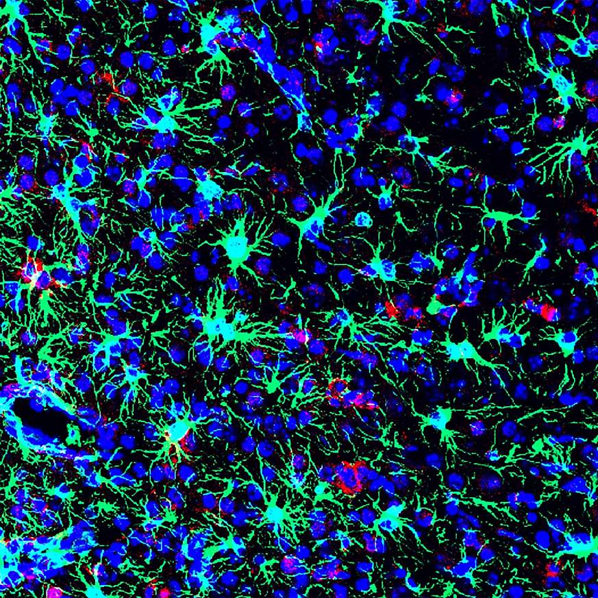 Image of Zika-infected mouse brain