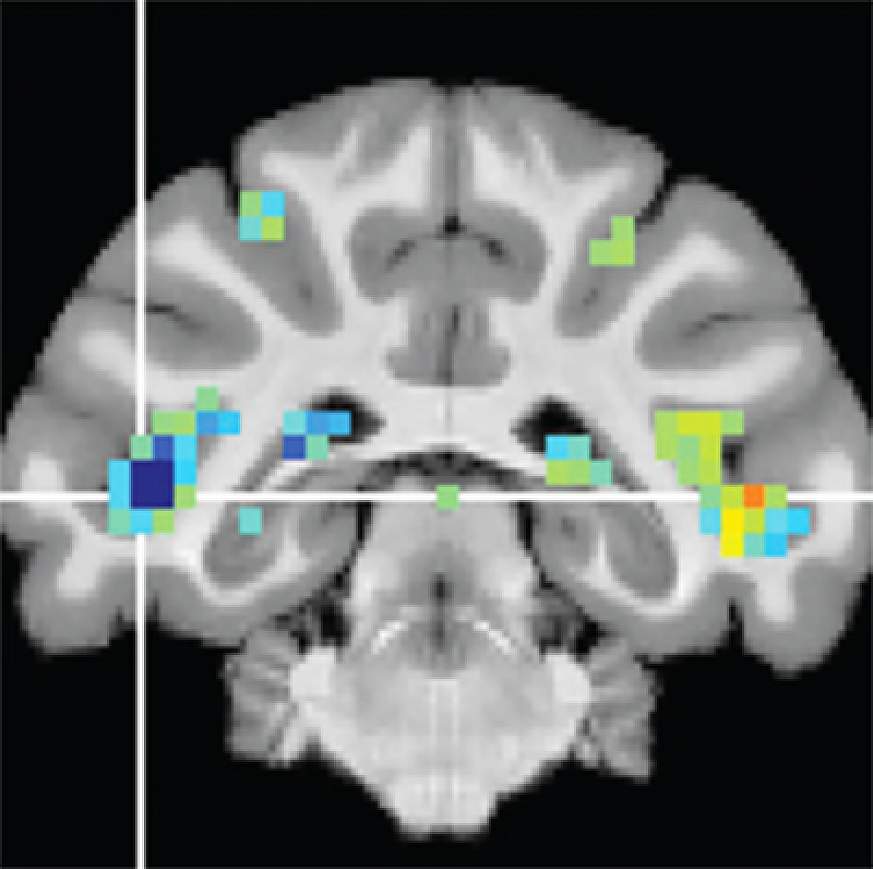 Image of fMRI scan