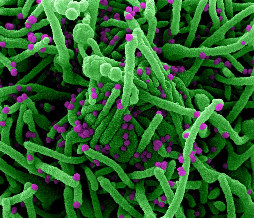 Novel Coronavirus SARS-CoV-2