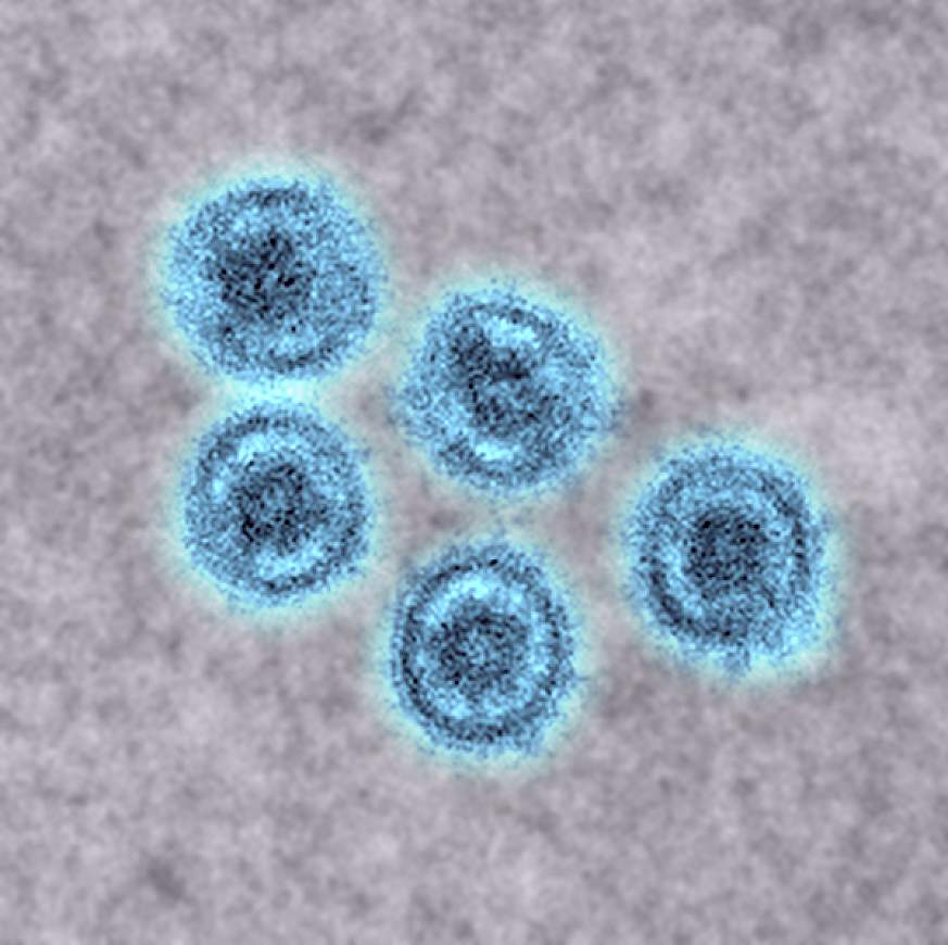 Image of Reston virus