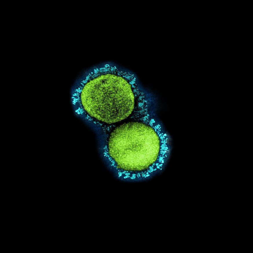 Novel Coronavirus SARS-CoV-2