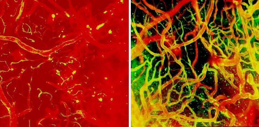 Image of mouse brain blood vessels one day and ten days after injury