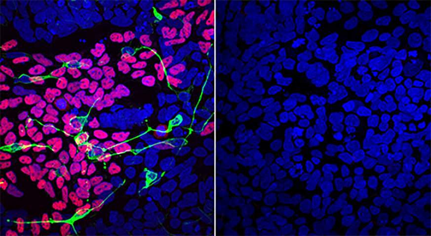 Fluorescent microscopy image of induced pluripotent stem cells