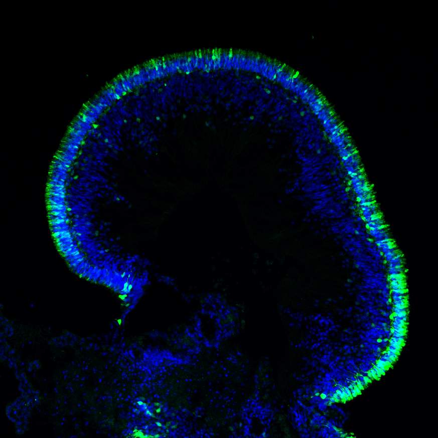  Image of a human retinal organoid.