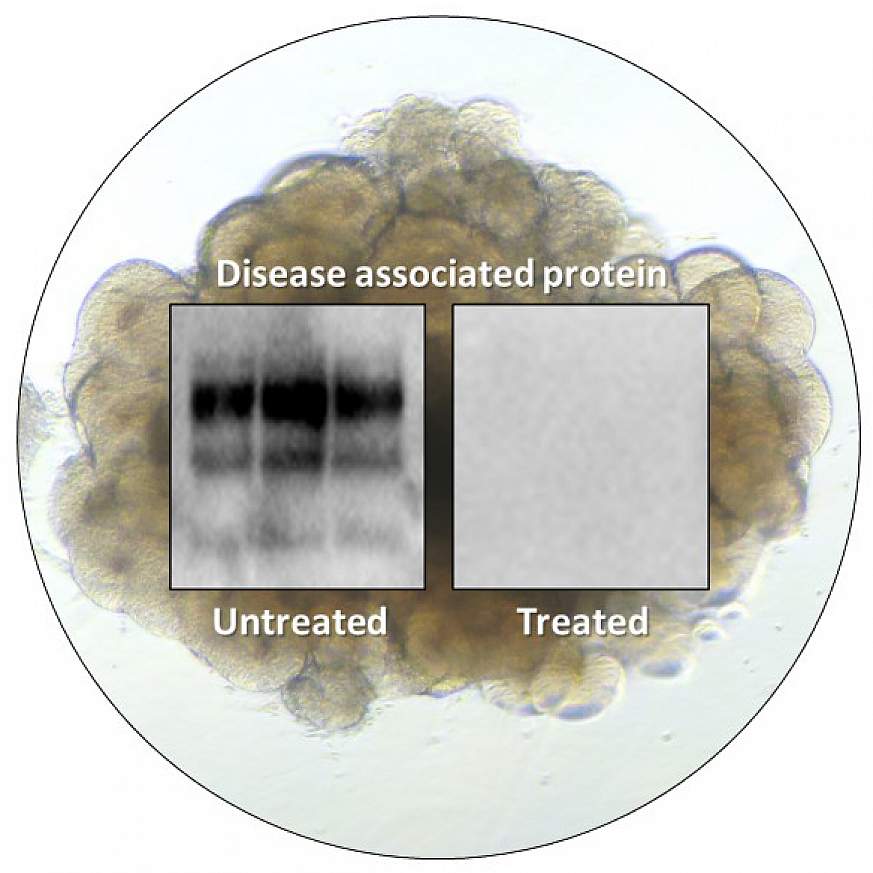 Image of a human cerebral organoid