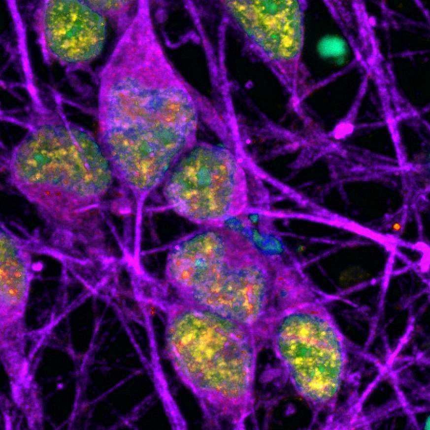 Microscopic image of neurons in the DNA repair process