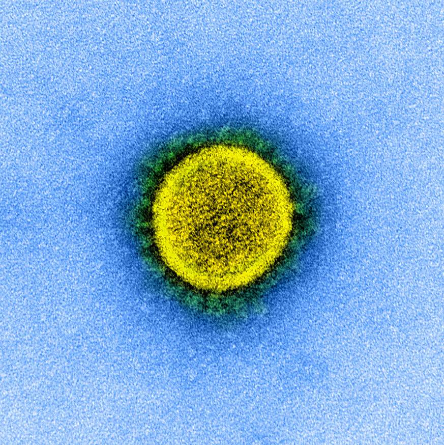SARS-CoV-2 virus particle
