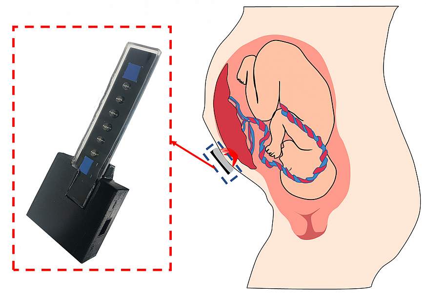 Image of the oxygen sensor next to a diagram of a fetus and placenta in the uterus