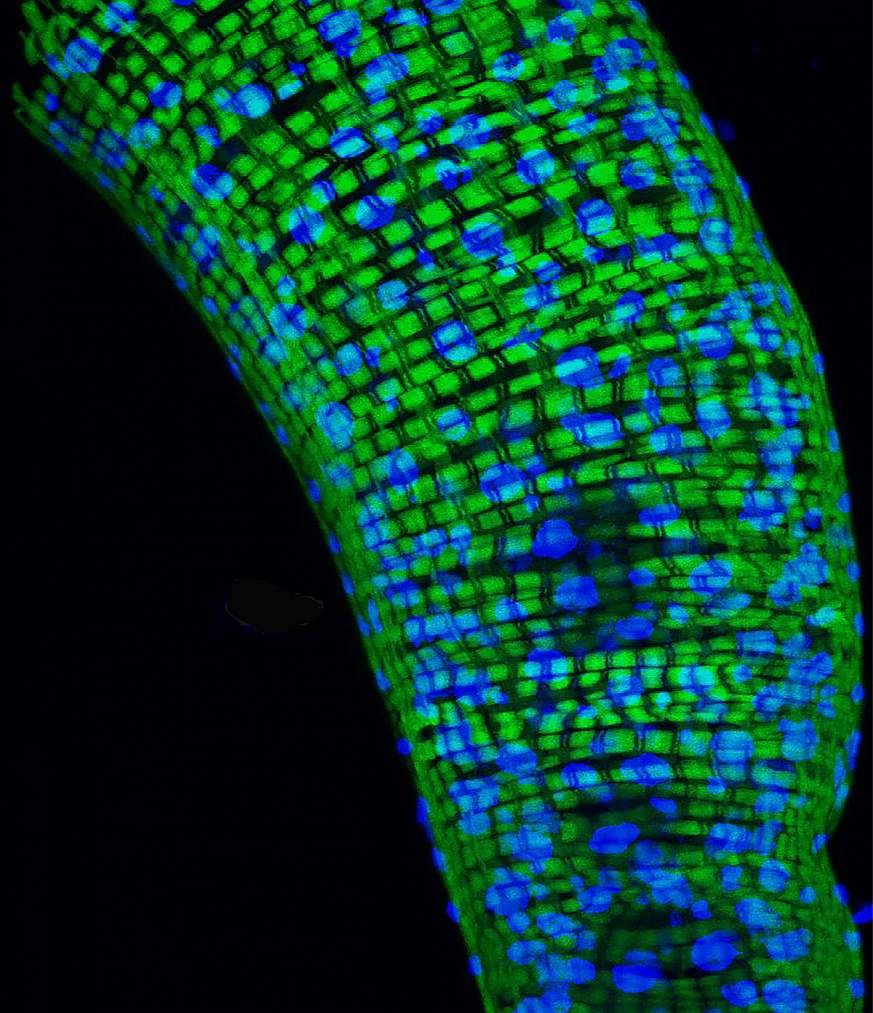 Image of a fly gut colored with blue and green spots.