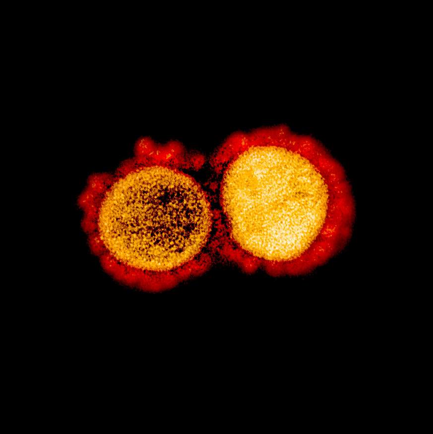 Novel Coronavirus SARS-CoV-2