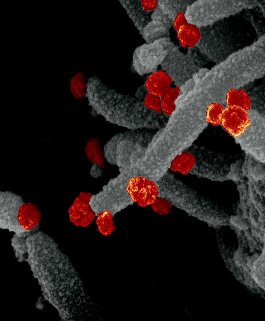 This scanning electron microscope image shows SARS-CoV-2 (round red particles) emerging from the surface of a cell cultured in the lab. SARS-CoV-2 is the virus that causes COVID-19.